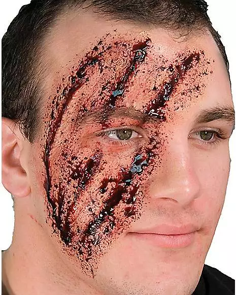 Shredded Scar Appliance 3 Shredded Scar Appliance